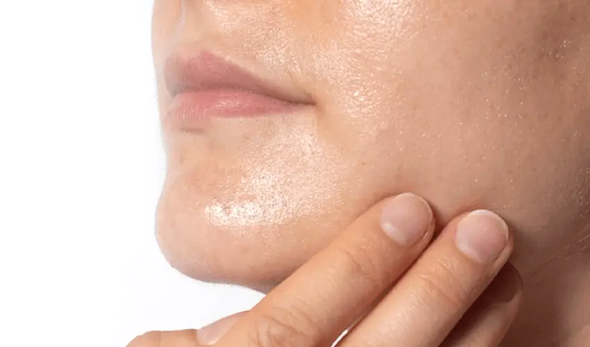 Avoid These 5 Mistakes For Oily Skin – Foxtale